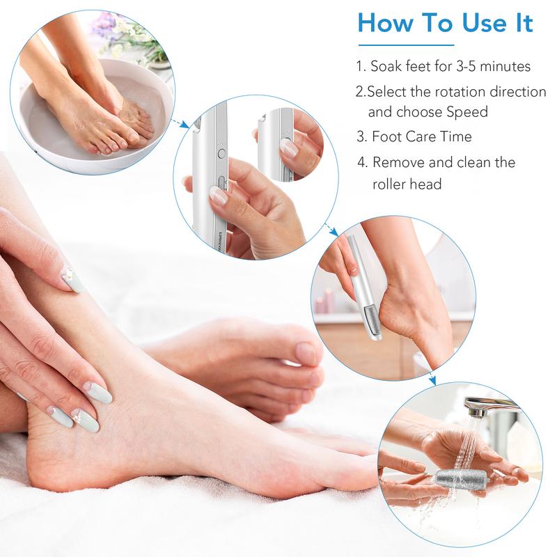 Fenvor Callus Remover