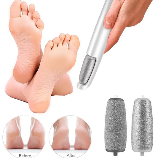Fenvor Callus Remover